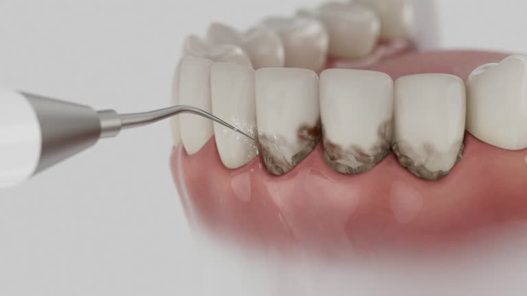 Trusted Tooth Extraction service in Coffeyville, KS - Dentist Open Now